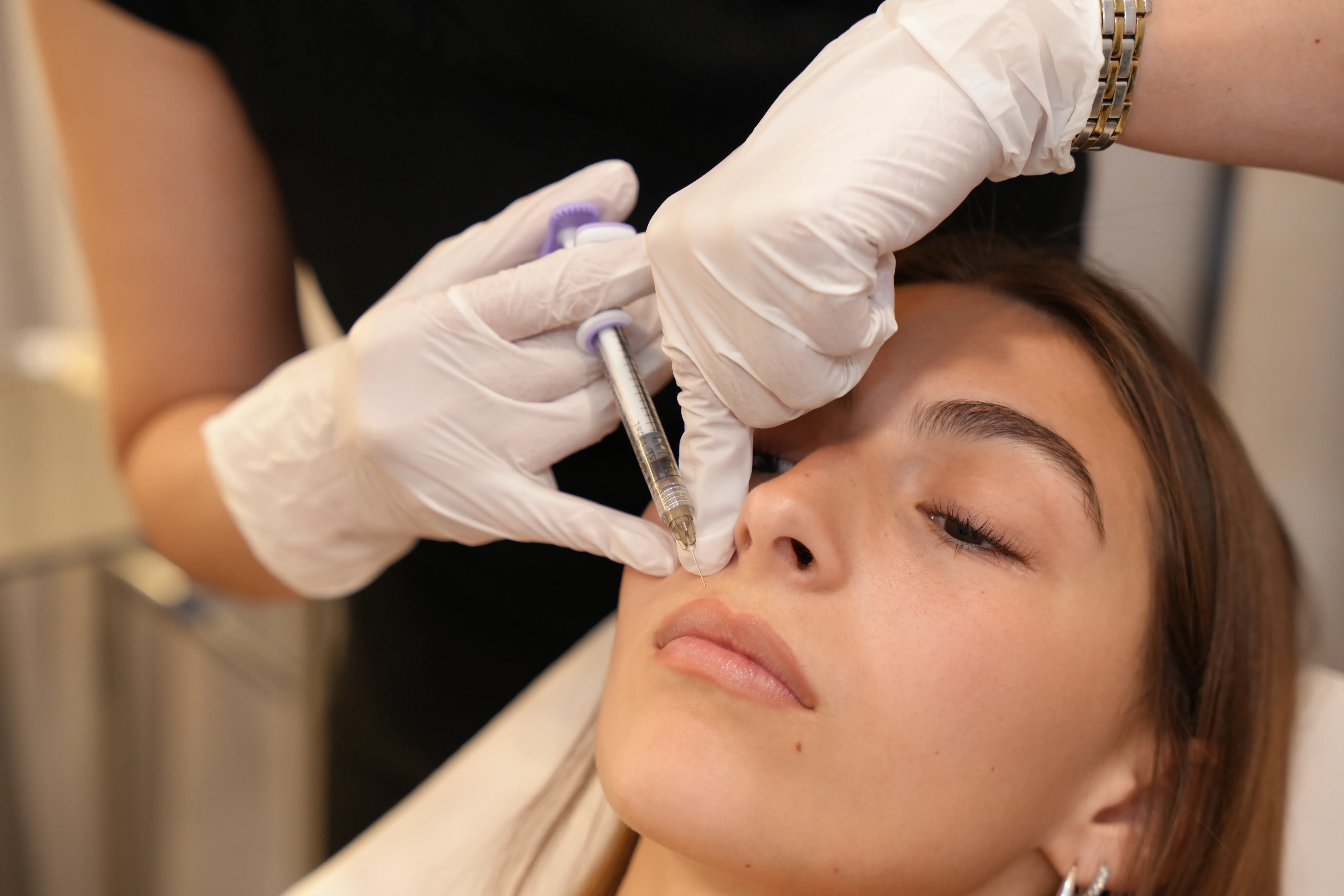 What to expect from Hyaluronic Acid Lip Fillers for Soft, Balanced Lips treatment at Toronto medical spa - treatment journey